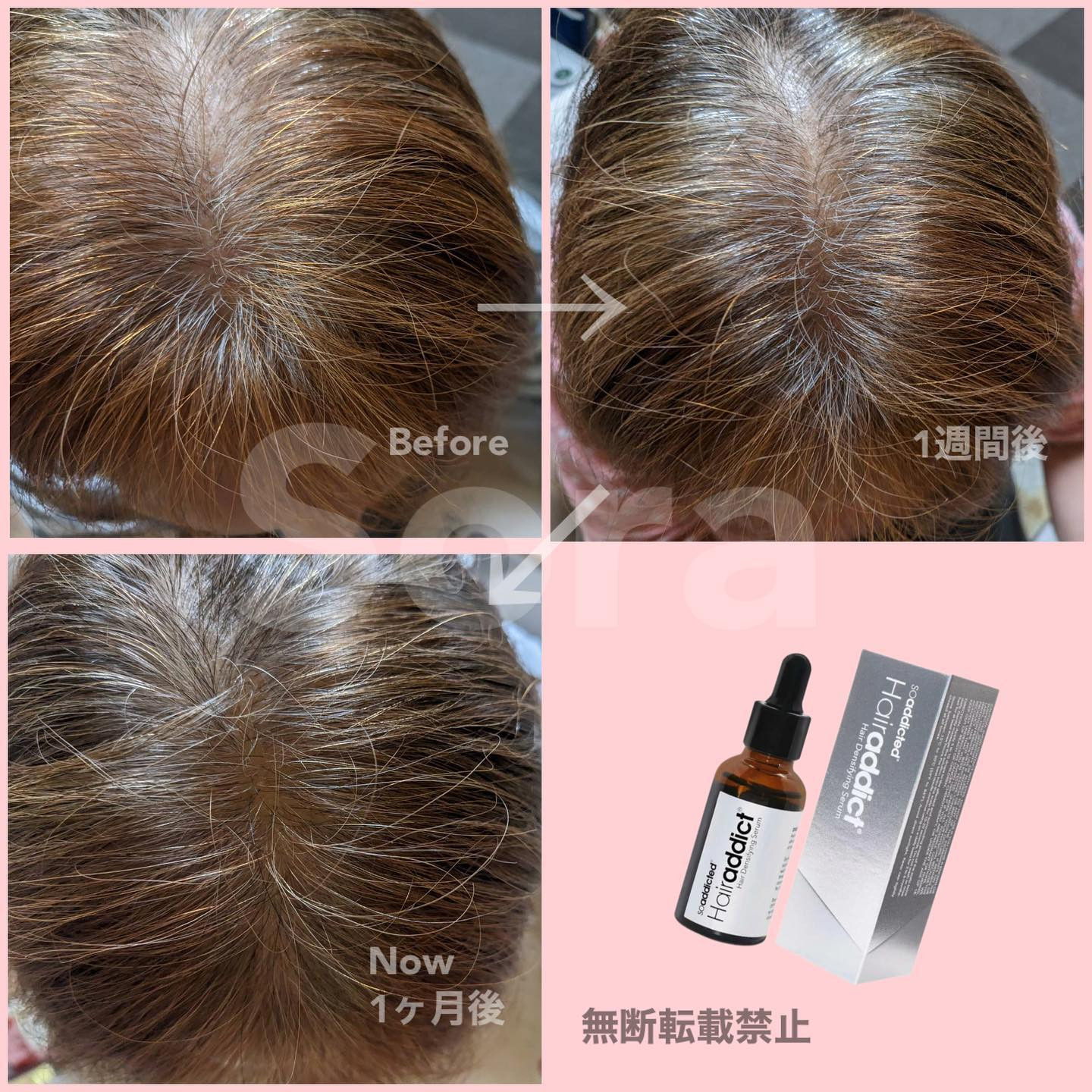 HAIRaddict(ヘアアディクト)セラム 30ml - トリートメント